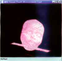 Figure 5. Manual tissue-depth data collection from a 3-D image of soft tissue and bone surfaces.