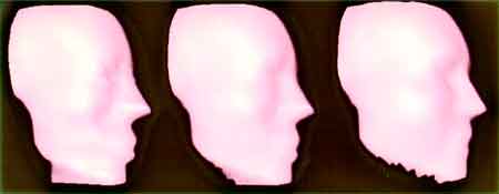 Figure 7. Interpolating between obese and emaciated facial reconstructions. Three facial images are shown. Available: http://forensic.shef.ac.uk/fatten.wrl