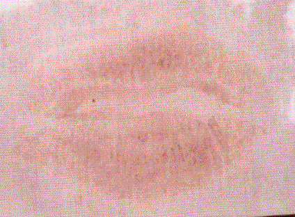 Photograph of a lip print.