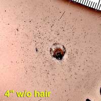 Figure 4 is a photograph of mannequin skin with deposition of gunshot residue.