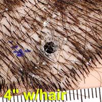 Figure 5 is a photograph of mannequin scalp with deposition of gunshot residue.