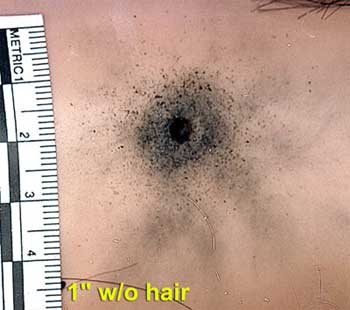 Figure 6 is a photograph of mannequin skin with deposition of gunshot residue.