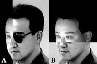 Set of two photos showing face-to-face superimposition of the 3D and 2D facial images. First photo shows a vertical wipe image, and the second photo shows a horizontal wipe image.