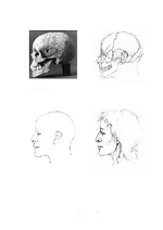 Figure 3. Younger Female (Skull Number 453) Who Had Alveolar Prognathism of the Upper Jaw