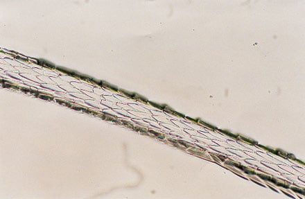 Figure 7 is a photomicrograph of proximal scale pattern (mink).