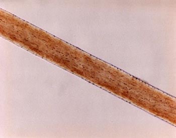 Figure 15 is a photomicrograph of cortical fusi in human hair.