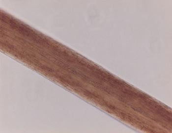 Figure 16 is a photomicrograph of pigment distribution in human hair.