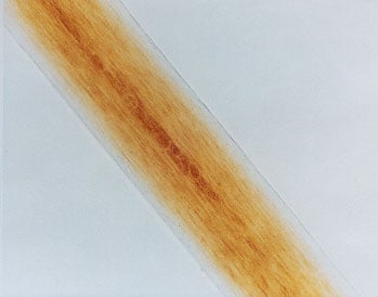 Figure 17 is a photomicrograph of pigment distribution in red human hair.