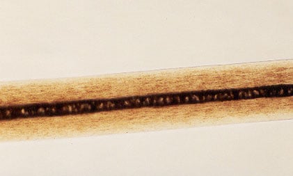 Figure 18 is a photomicrograph of pigment distribution in animal hair.