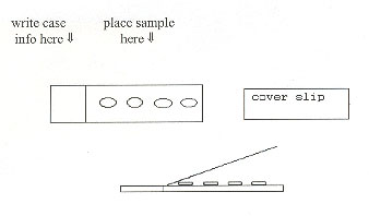 Figure 23 is an illustration of slide preparation.
