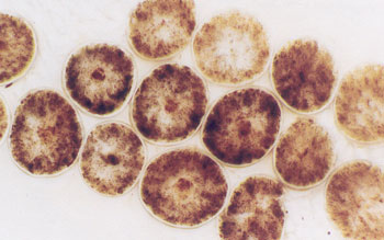 Figure 28 is a photomicrograph of cross-section of Mongoloid hair.