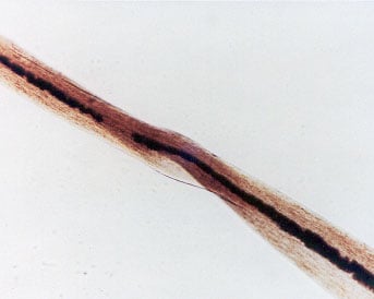 Figure 30 is a photomicrograph of pubic hair buckling.