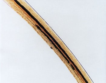 Figure 36 is a photomicrograph of beard hair medulla (doubled).