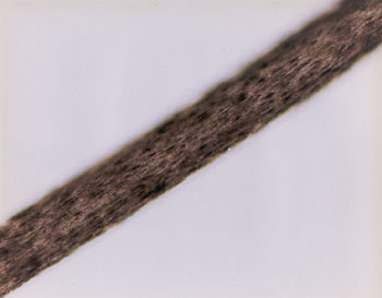 Figure 40 is a photomicrograph of head hair of Negroid individual.