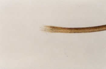 Figure 53 is a photomicrograph of abraded hair tip.