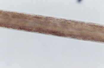 Figure 59 is a photomicrograph of inner cuticle margins.