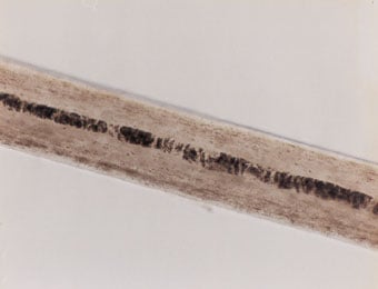 Figure 60 is a photomicrograph of inner cuticle margins.