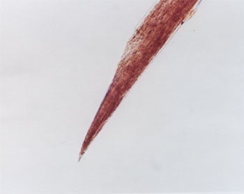 Figure 72 is a photomicrograph of razor-cut hair.
