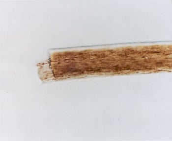 Figure 73 is a photomicrograph of broken hair.