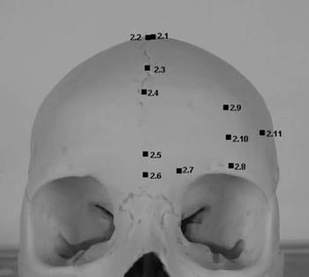 Representation of landmarks on the frontal bone: vertex, bregma, trichion, metopion, ophryon, glabella, lateral glabella, supraorbital, frontal eminence, lateral frontal, frontotemporale.