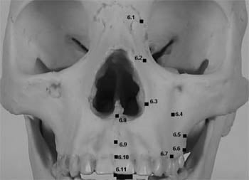 Representation of landmarks on the maxilla: dacryon, lateral nasal, alare, fossa canina, zygomaxillare, supra-M2, supracommissural, subnasale, midphiltrum;, prosthion, stomion.