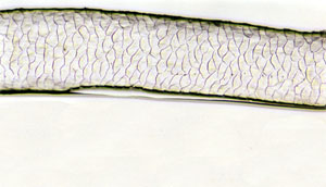 Figure 113 is a photomicrograph of a scale pattern of moose hair.