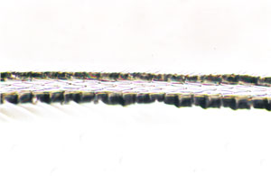Figure 121 is a photomicrograph of a scale cast of mink hair (proximal region).