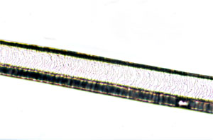 Figure 122. Photomicrograph of Scale Cast of Mink Hair (Distal Region)
