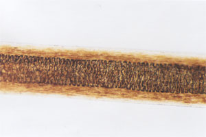 Figure 123 is a photomicrograph of shield area of muskrat hair.