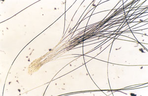 Figure 126 is a photomicrograph of chinchilla hair bundles. 