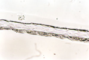 Figure 131 is a photomicrograph of a scale cast of red fox hair (proximal region).