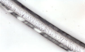 Figure 136 is a photomicrograph of a scale cast of bear hair.