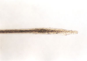Figure 139 is a photomicrograph of dog root.