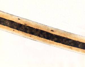 Figure 140 is a photomicrograph of dog hair.