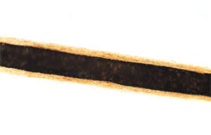 Figure 143 is a photomicrograph of horse hair. 