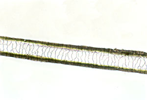 Figure 146 is a photomicrograph of a scale cast of goat hair.
