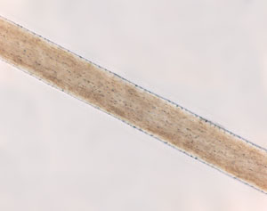 Figure 96 is a photomicrograph of cortical fusi in human hair.