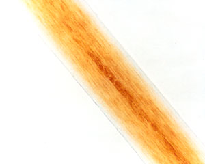 Figure 98 is a photomicrograph of pigment distribution in red human hair.