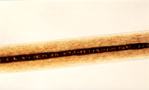 Figure 99 is a photomicrograph of pigment distribution in animal hair.
