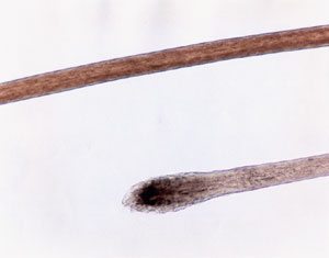 Figure 103 is a photomicrograph of human hair root.