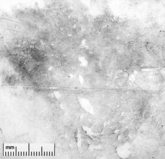 Figure 11 shows a palm print recorded without using the boiling technique.
