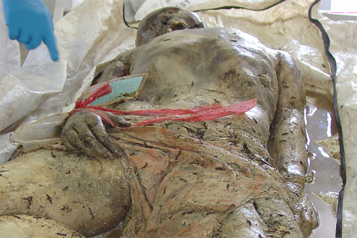 Figure 1 shows a water-damaged body with macerated hands.