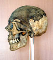 Photograph of naturally mummified skeleton (side view) of Anital Simon found in Hungary in the mid-1990s.