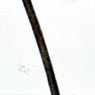 Figure 3: Color microscopic slide of one of 16 hair samples from individuals with both African-American and Caucasian ancestry. Click for enlarged view.