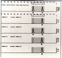 Graphic image showing the allele profiles of amplified genetic samples